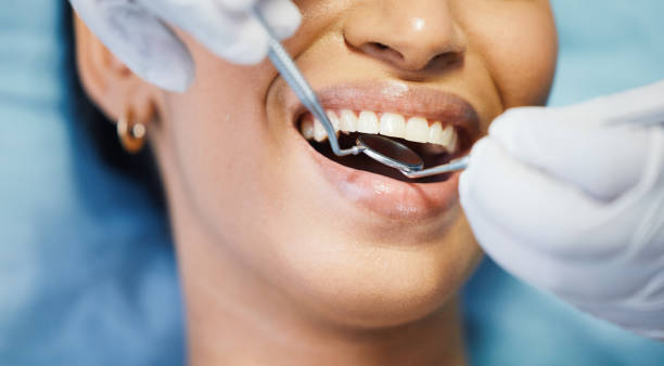 Best Knocked-Out Tooth (Avulsed Tooth) Treatment in Seward, AK